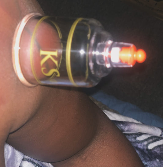 Cupping Therapy